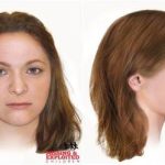 Jane Doe Facial Reconstruction