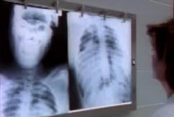 Dr. Ward looking at X-rays from Andre's Autopsy