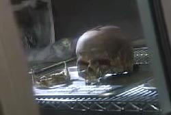 The skull of Linda Sherman on a table in a lab