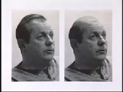 Left: William Peter Fischer with full head of hair, Right: William Peter Fisher with a bald spot